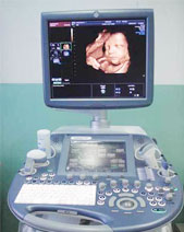 美国G-E8高清四维彩超