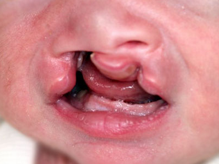 ������Լ���̥������Щ����